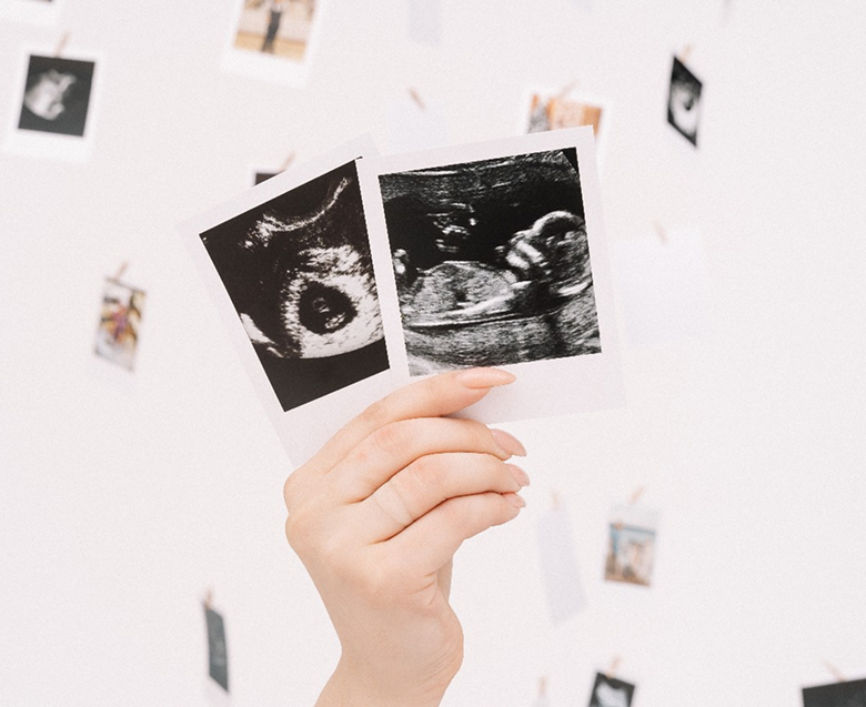 Как пациентка без яйцеклеток родила двоих детей